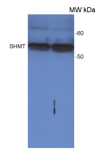 western blot detection using anti-SHMT antibody